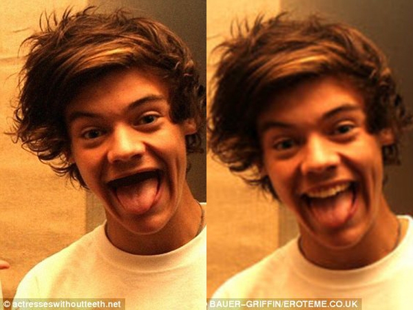 
	
	Harry Styles, anh chàng điển trai của nhóm One Direction.